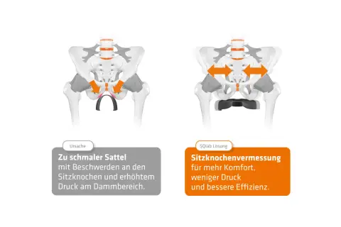 Illustrationen zeigen Beckenknochen. Links: zu schmaler Sattel, Druck auf Sitzknochen. Rechts: Sitzknochenvermessung für mehr Komfort.