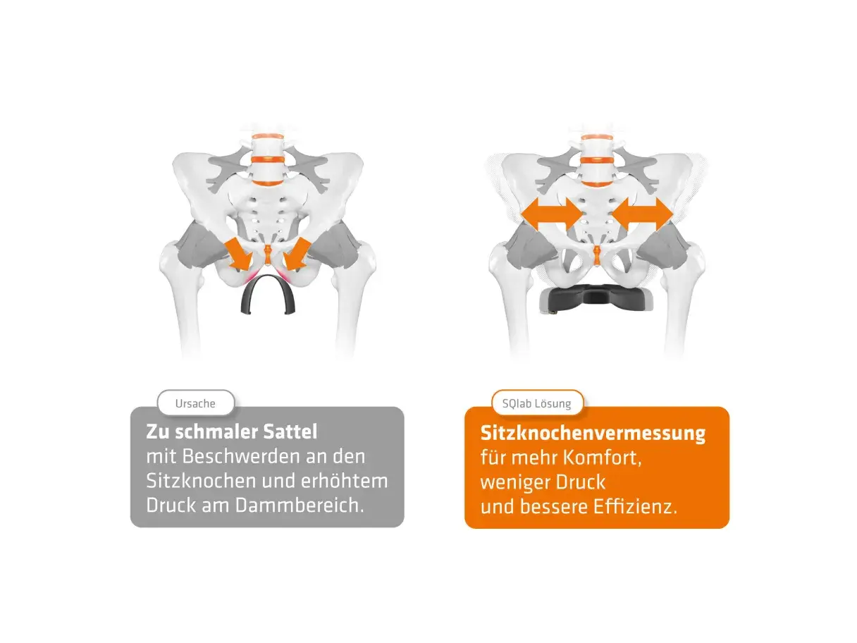 Illustrationen zeigen Beckenknochen. Links: zu schmaler Sattel, Druck auf Sitzknochen. Rechts: Sitzknochenvermessung für mehr Komfort.